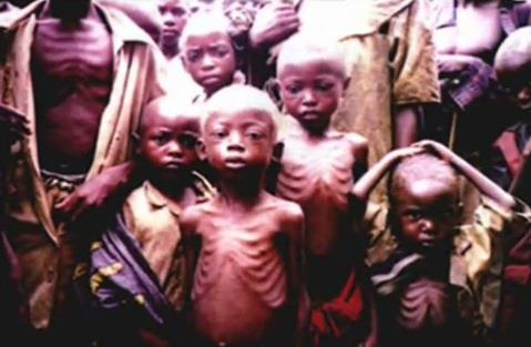 starving children (2)